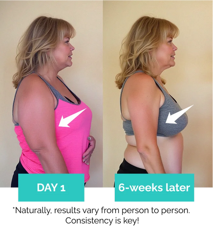 SkinForm™ – Sculpting Set ( Top+Leggings)