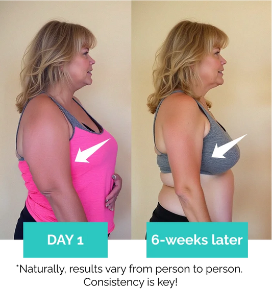 SkinForm™ – Sculpting Set ( Top+Leggings)