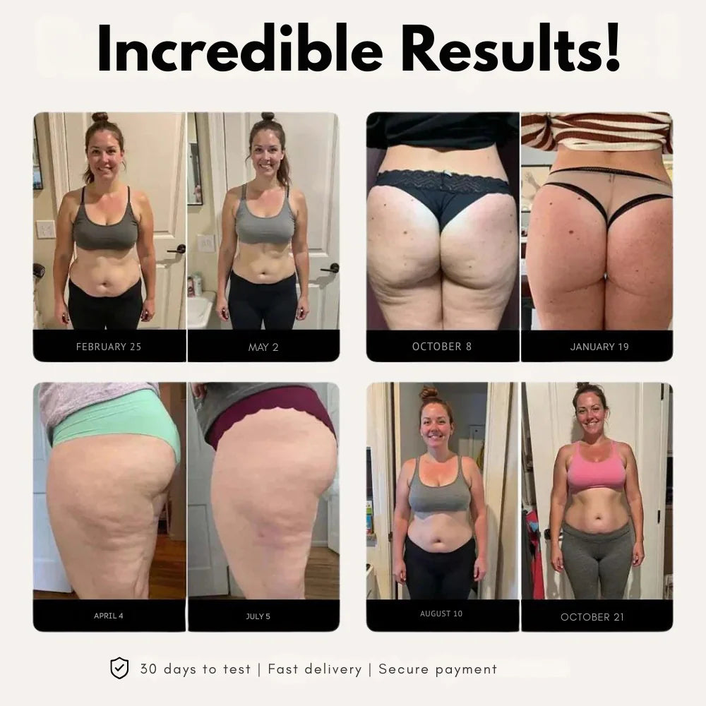 SkinForm™ – 3D Leggings Short