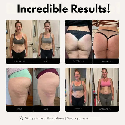 SkinForm™ – 3D Leggings Short