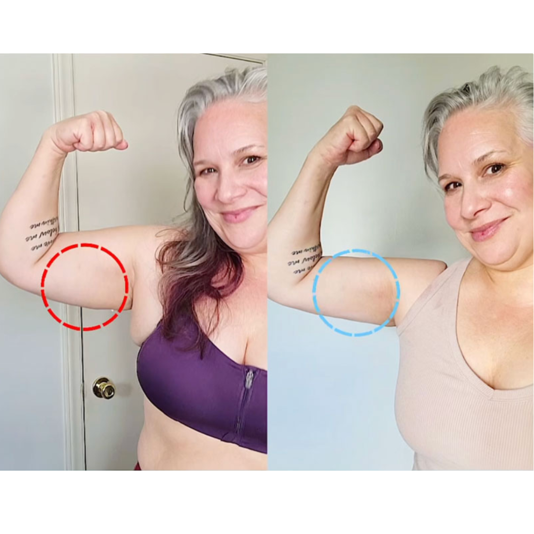 SkinForm™ – Sculpting Set ( Top+Leggings)