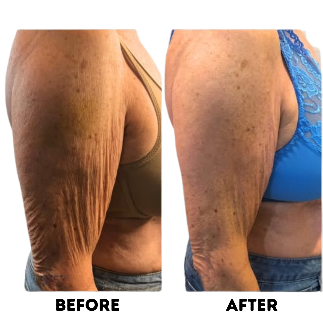 SkinForm™ – Sculpting Set ( Top+Leggings)